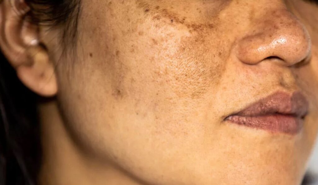 Contoh-Produk-Skincare-untuk-Mengatasi-Hiperpigmentasi-Bandel-dan-Analisis-Setiap-Produk